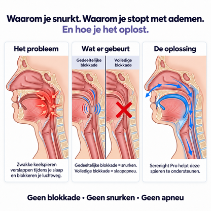 Serenight PRO - Verhelpt Snurken & Slaapapneu in 7 dagen